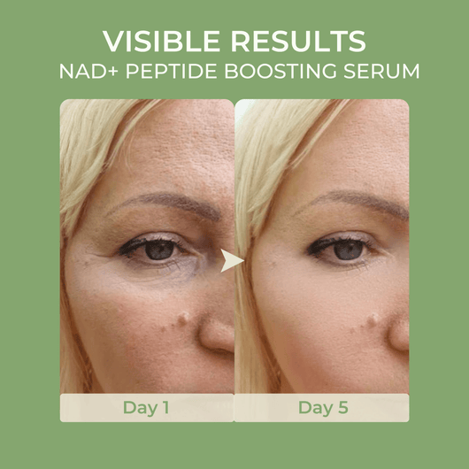 Before and after results showing smoother skin texture using Olivine Beauty NAD plus peptide boosting serum from day 1 to day 5