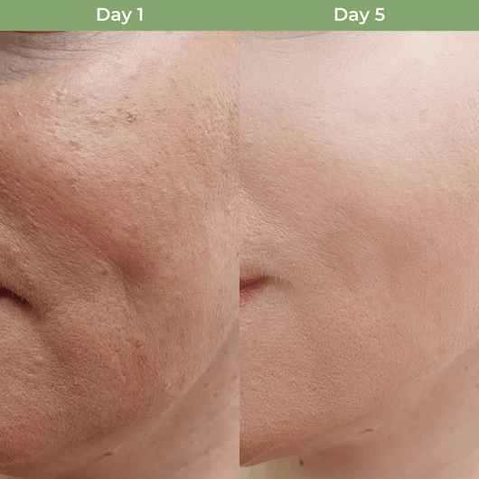 Close up before and after skin texture improvement using Olivine Beauty NAD plus peptide serum showing smoother appearance