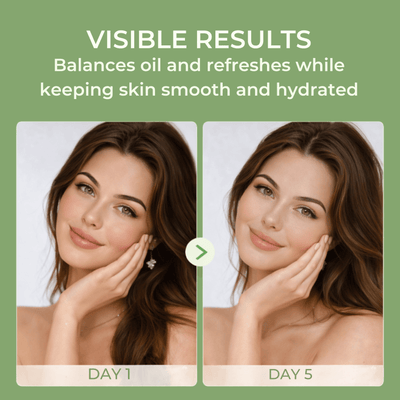 Before and after showing oily skin improved to balanced smooth hydrated skin