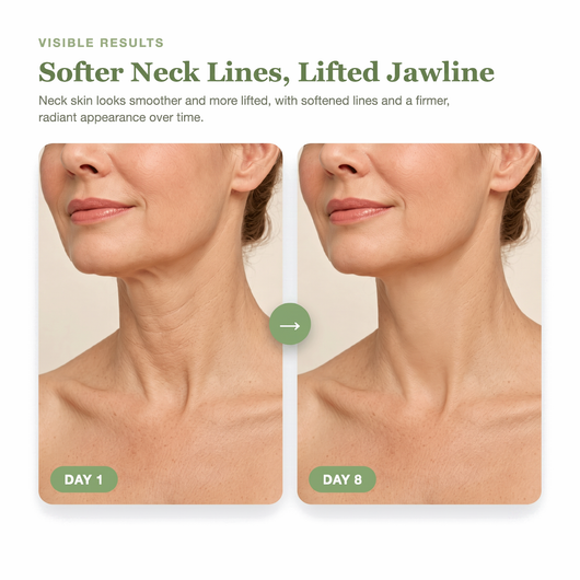 Day 1 to Day 8 showing softer neck lines and a firmer, more lifted looking jawline with the green Olivine Beauty PDRN Collagen Gua Sha Neck Wrinkle Cream