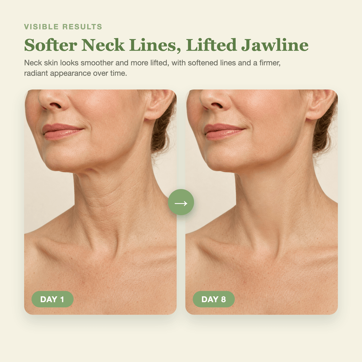 Day 1 to Day 8 showing softer neck lines and a firmer, more lifted looking jawline with the Olivine Beauty PDRN Collagen Gua Sha Neck Wrinkle Cream