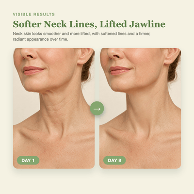 Day 1 to Day 8 showing softer neck lines and a firmer, more lifted looking jawline with the Olivine Beauty PDRN Collagen Gua Sha Neck Wrinkle Cream