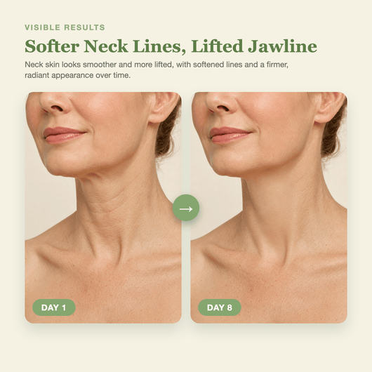 Day 1 to Day 8 showing softer neck lines and a firmer, more lifted looking jawline with the Olivine Beauty PDRN Collagen Gua Sha Neck Wrinkle Cream
