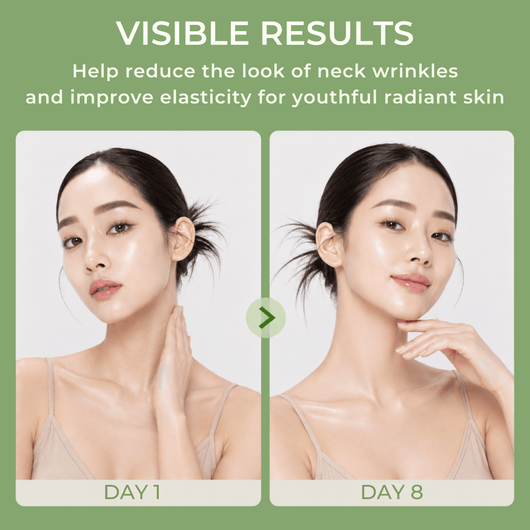 Before and after comparison showing smoother, firmer-looking neck and jawline after using Olivine Beauty PDRN Collagen Gua Sha Neck Wrinkle Cream.