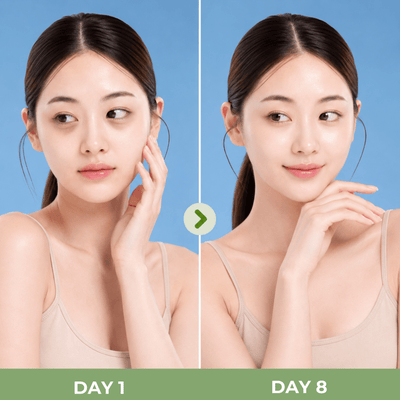 Before and after comparison highlighting brighter, smoother, and refreshed-looking under eyes with Olivine Beauty PDRN Pink Caffeine Collagen Eye Patch.