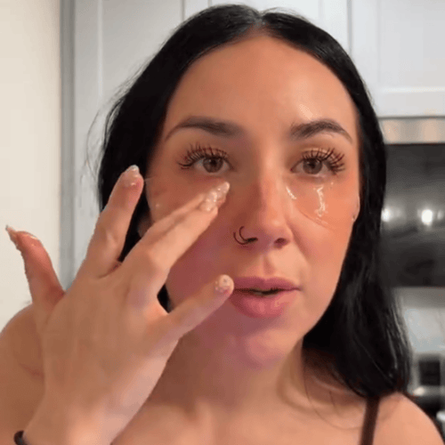 Real customer under-eye results with the PDRN eye patches