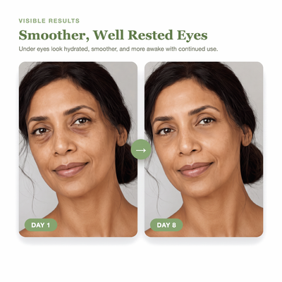 Day 1 to Day 8 showing smoother, well rested looking under eyes with the Olivine Beauty PDRN Green Caffeine Collagen Eye Patch