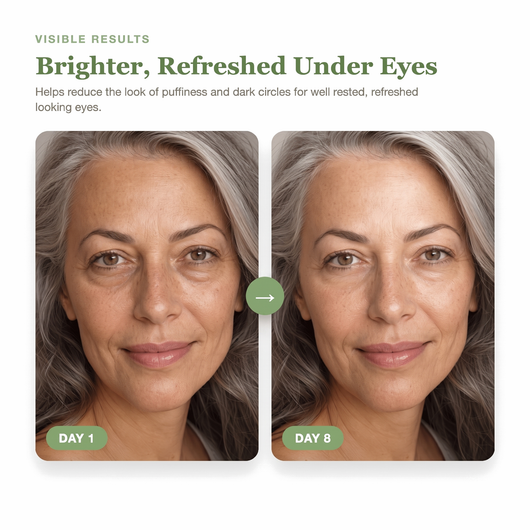 Day 1 to Day 8 showing brighter, refreshed, less puffy looking under eyes with the Olivine Beauty PDRN Green Caffeine Collagen Eye Patch