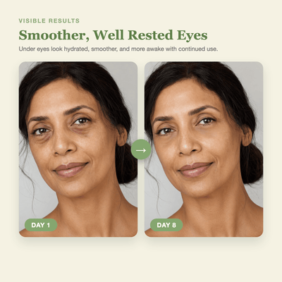 Day 1 to Day 8 showing smoother, well rested looking under eyes with the Olivine Beauty PDRN Pink Caffeine Collagen Eye Patch