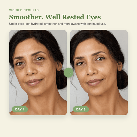 Day 1 to Day 8 showing smoother, well rested looking under eyes with the Olivine Beauty PDRN Pink Caffeine Collagen Eye Patch