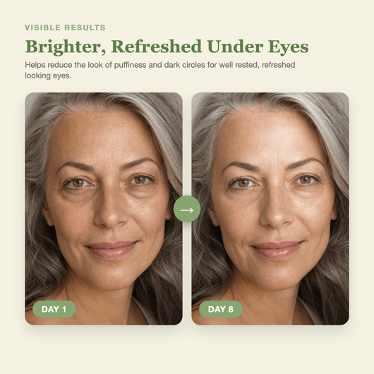 Day 1 to Day 8 showing brighter, refreshed, less puffy looking under eyes with the Olivine Beauty PDRN Pink Caffeine Collagen Eye Patch