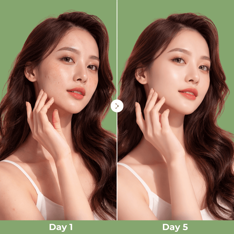 Day 1 vs Day 5 skin improvement comparison using Olivine Beauty Peel Shot