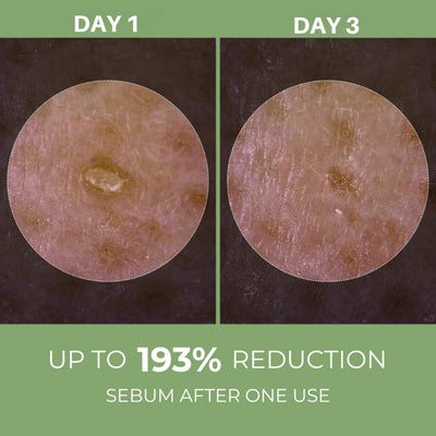 Olivine Beauty Peel Shot exfoliating ampoule helping reduce sebum and refine pores