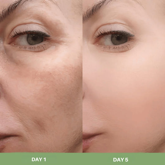 Skin texture improvement after using Olivine Beauty Peel Shot rice exfoliating ampoule