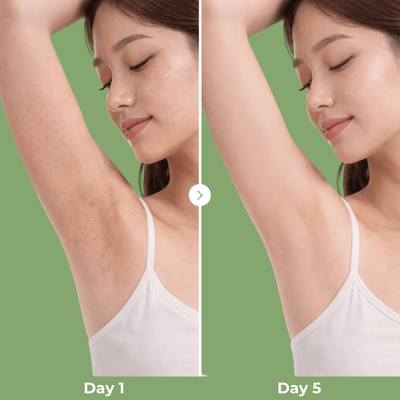 Before and after comparison of underarm skin using Olivine Beauty Peel Shot Spray showing smoother, brighter and more even-looking skin from Day 1 to Day 5.