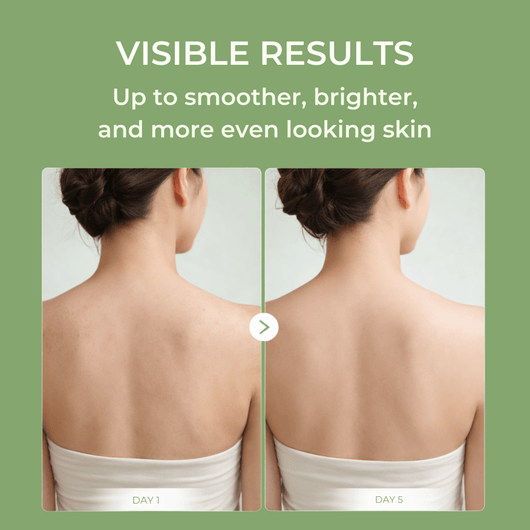 Before and after comparison of upper back skin using Olivine Beauty Peel Shot Spray showing smoother, brighter, more even-looking skin from Day 1 to Day 5.