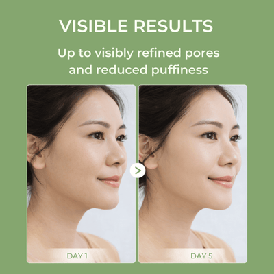 Olivine Beauty before and after showing visibly refined pores and reduced puffiness after skincare use