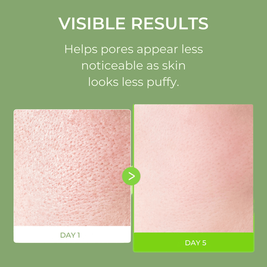 Olivine Beauty Pore Tox Gel Mask visible results showing before and after skin improvement with pores appearing less noticeable and smoother skin texture