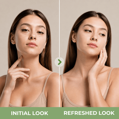 olivine beauty model showing smoother and more refreshed under eye appearance