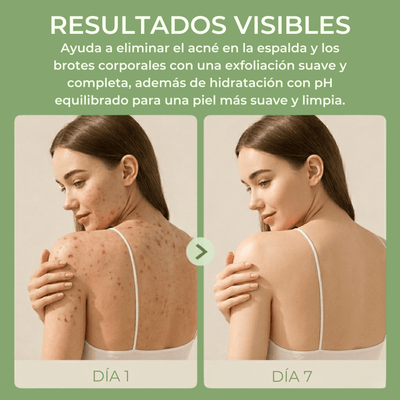 Comparación de piel con menos brotes y textura más suave después del uso constante