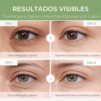 Resultados visibles de Olivine Beauty crema para ojeras mostrando apariencia más luminosa y suave