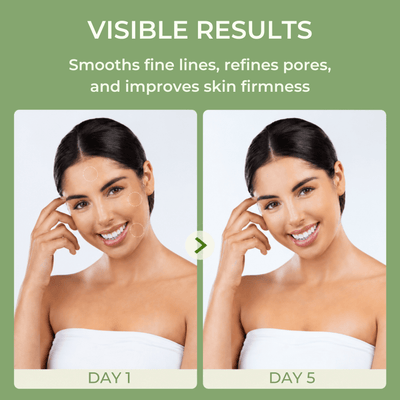 Skin texture comparison showing smoother and more refined pores from day 1 to day 5