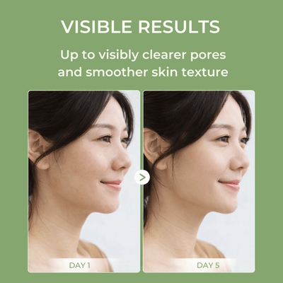 Visible skin texture improvement using Olivine Beauty Silk Lifting Peptide Ampoule showing smoother pores and healthier looking skin