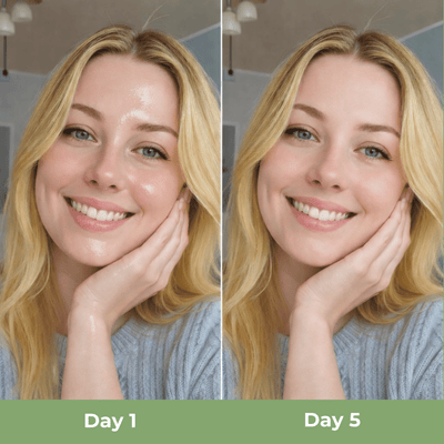 Oily skin transforming to smooth balanced hydrated skin with lightweight moisturizer