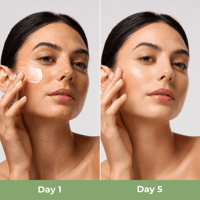 Close up skin transformation showing improved hydration and smoother texture