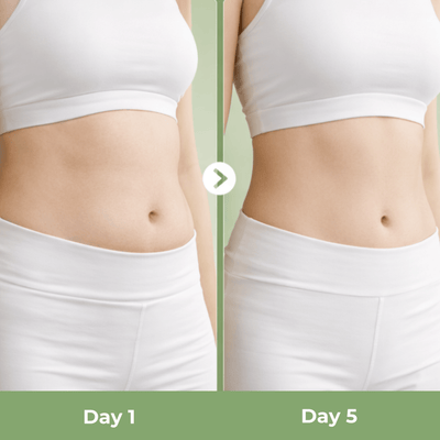 Olivine beauty slimming patch comparison showing smoother and more balanced looking stomach after consistent use