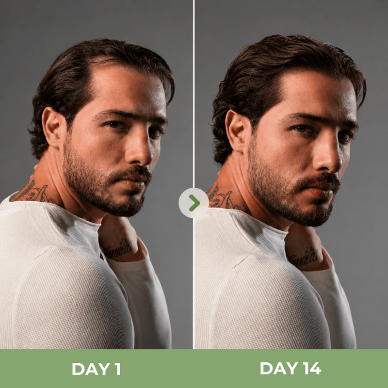 Side-by-side comparison of male model showing healthier-looking fuller facial hair from day 1 to day 14.
