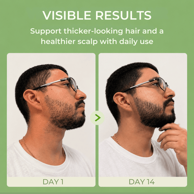 Before and after day 1 and day 14 comparison showing fuller-looking beard and healthier hair appearance.