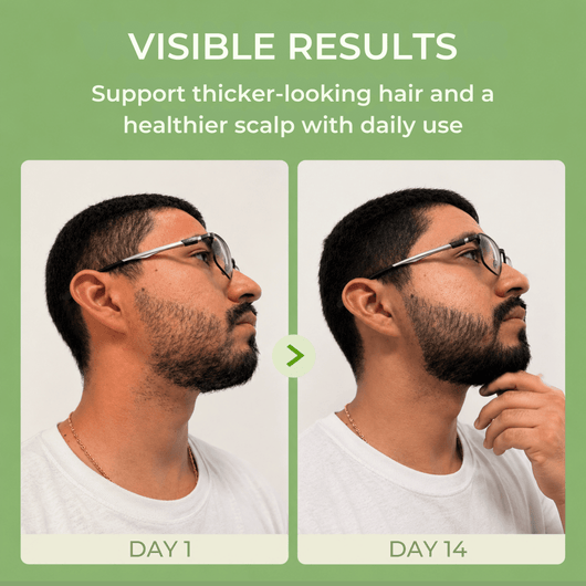 Before and after day 1 and day 14 comparison showing fuller-looking beard and healthier hair appearance.