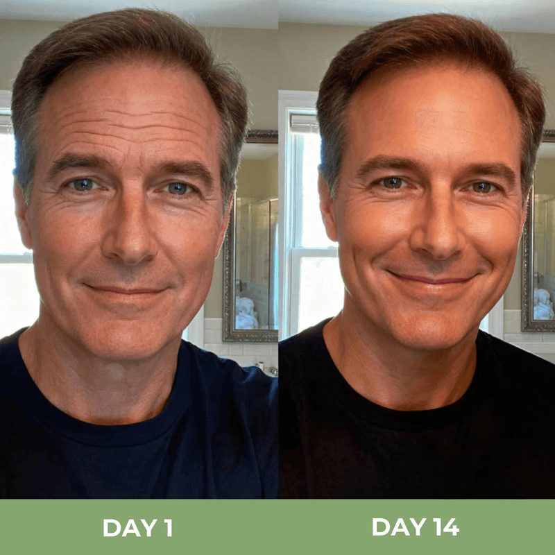Before and after comparison showing improved skin texture and smoother looking appearance