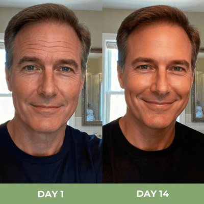 Before and after comparison showing improved skin texture and smoother looking appearance
