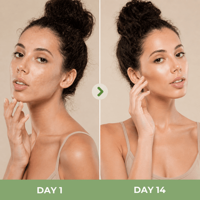 Skin transformation showing softer smoother and more hydrated appearance after consistent use
