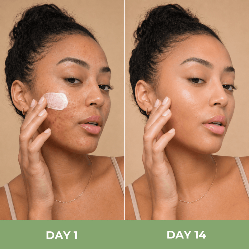 day 1 vs day 14 skin showing smoother clearer hydrated appearance