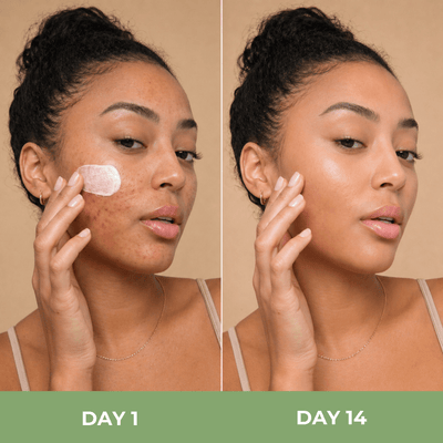 day 1 vs day 14 skin showing smoother clearer hydrated appearance