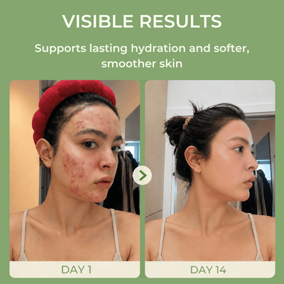 before and after skin improvement showing smoother and hydrated skin results
