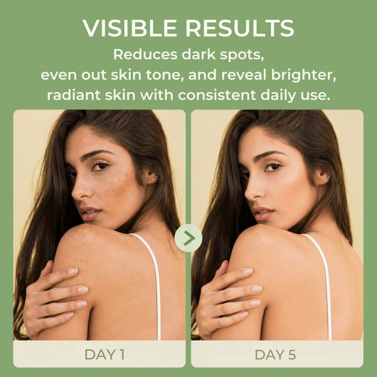 Before and after showing reduction in dark spots and brighter skin tone after using toner pads