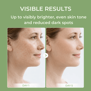 TX Tranexamic Acid Cream