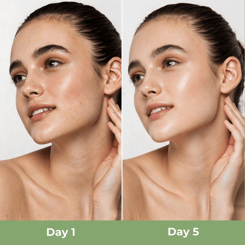 Before and after results showing smoother and clearer skin appearance