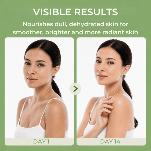 Day 1 to Day 14 radiant skin transformation with NIDA moisturizing cream