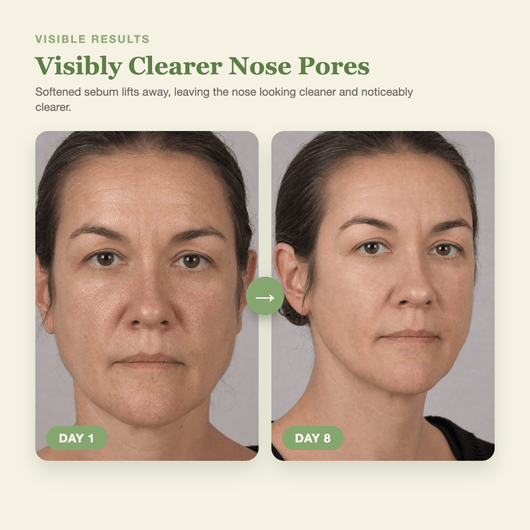Olivine Cactox 3 Step Nose Mask Pack Day 1 to Day 8 visible results