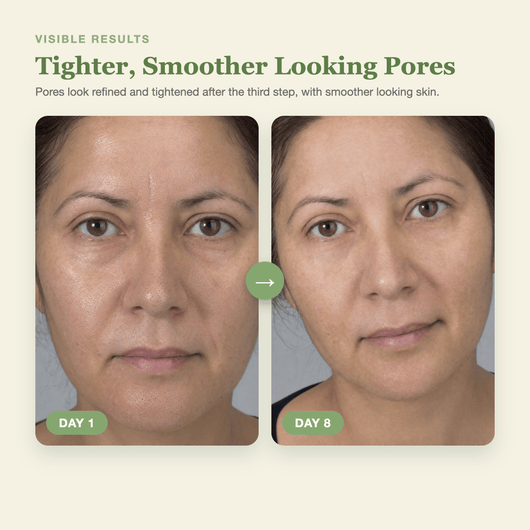 Olivine Cactox 3 Step Nose Mask Pack Day 1 to Day 8 visible results