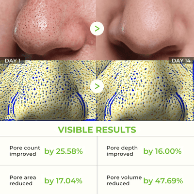 Olivine Cactox Nose Pore Pack before and after showing visible pore improvement, reduced pore size, and smoother nose skin appearance