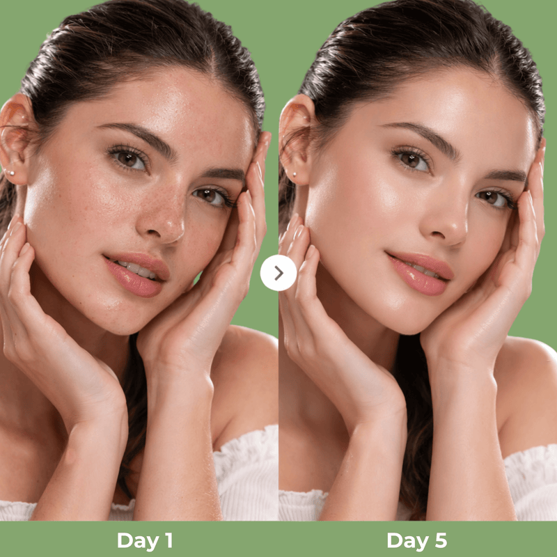 Olivine Cactox Nose Pore Pack results showing smoother, clearer, and more refined skin after consistent use