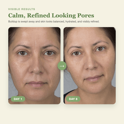 Olivine Cactox Pore Relief Jelly Toner Pads and Serum Mist Duo Day 1 to Day 8 visible results