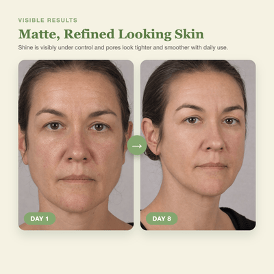 Olivine Cactox Pore Relief Multi Balm Day 1 to Day 8 visible results