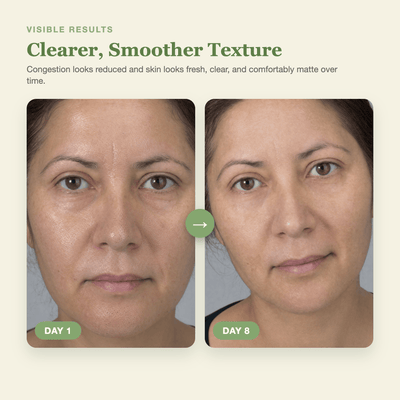 Olivine Cactox Pore Relief Multi Balm Day 1 to Day 8 visible results